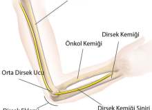 Ulnar Sinir Sıkışması Ulnar Sinir Sıkışması