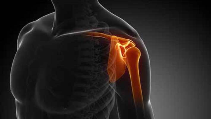 Rotator Manşet Yırtıkları (Omuz Döndürücü Tendon Manşeti Yırtıkları)