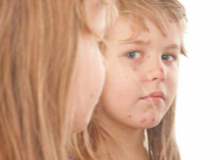 Viral Cilt Enfeksiyonları Viral Cilt Enfeksiyonları