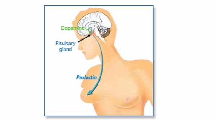 Prolaktin Hormonu Yüksekliği