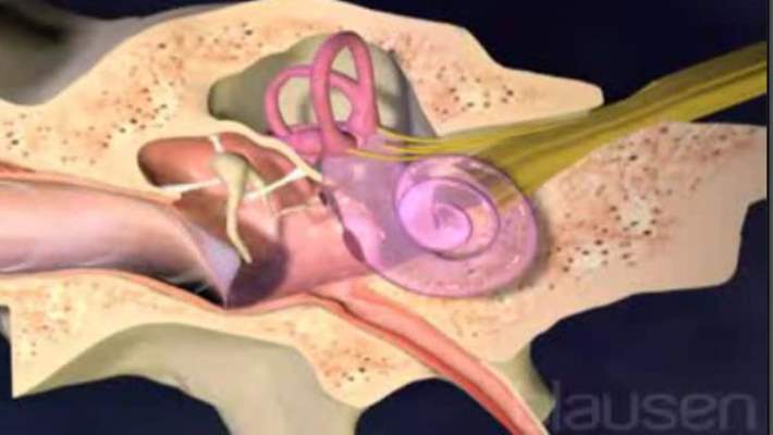 Kulak İltihabı Ve Kulak Tüpü Ameliyatı