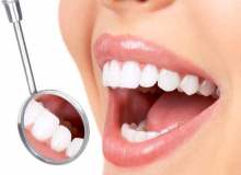 Diş Kaplamaları Diş Kaplamaları