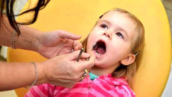 Bebeklerin Ve Küçük Çocukların Temel Diş Bakımı