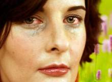 Yüz İmplantları Yüz İmplantları