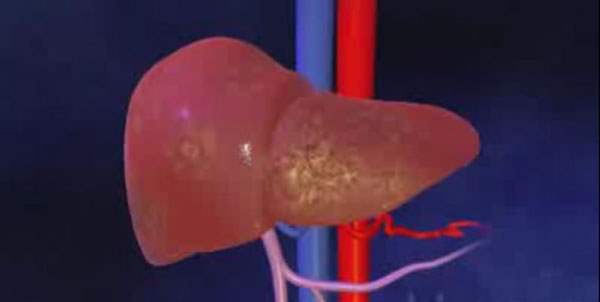 Karaciğer Büyümesi (Hepatomegali)