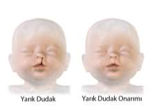 Pediyatrik Plastik Cerrahi Pediyatrik Plastik Cerrahi
