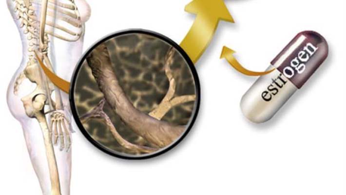 Hormon Replasman Tedavisi (Hormon Yenileme Tedavisi)