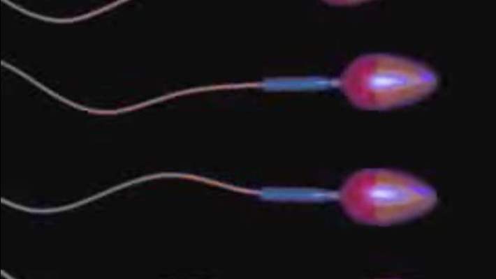 Kısırlık İçin İntrasitoplazmik Sperm Enjeksiyonu