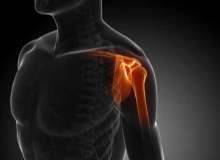 Omuz Kireçlenmesi İçin Egzersizler Omuz Kireçlenmesi İçin Egzersizler