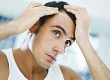 Saç Dökülmesini Önlemek İçin Tavsiyeler