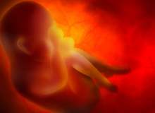 Ölü Doğumun Sebepleri Nelerdir Ölü Doğumun Sebepleri Nelerdir