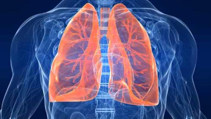 Metastatik Akciğer Kanseri