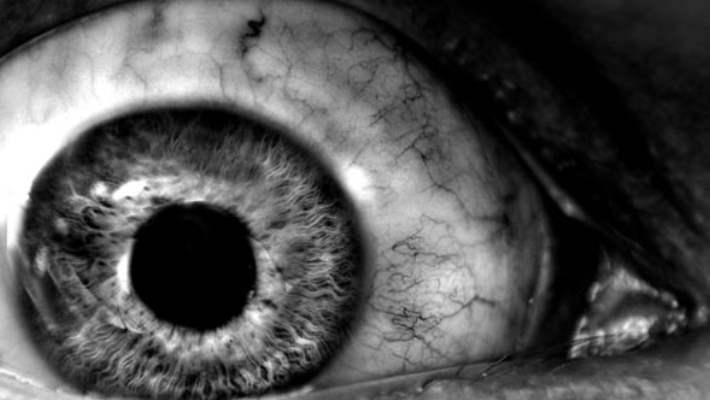 Uyku Apne Sendromu Nasıl Yaşanır?