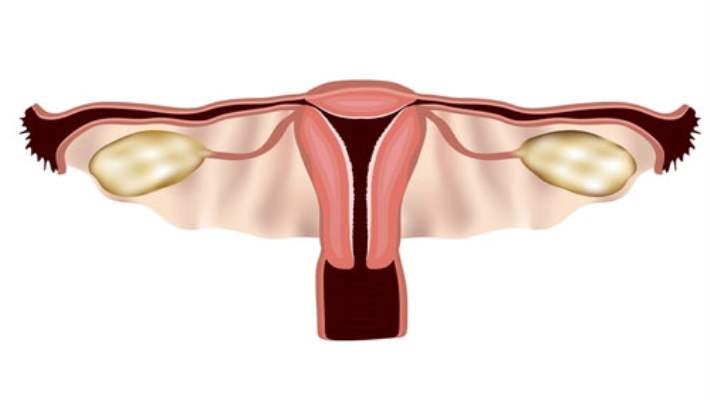 Vajina Daraltma İşlemi Nasıl Yapılır?