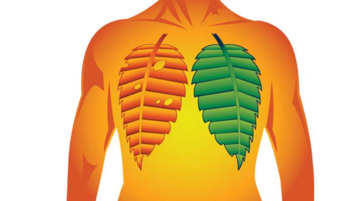 Akciğer Kanseri Ve Neden Olan Etmenler