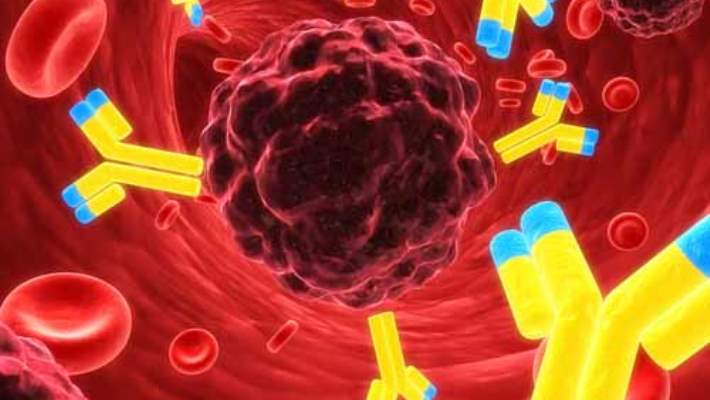 Kronik Lenfositik Lösemi Nasıl Teşhis Edilir?