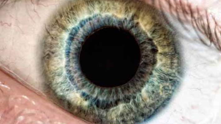 Göz Melanomun Tedavi Yöntemleri Nelerdir?