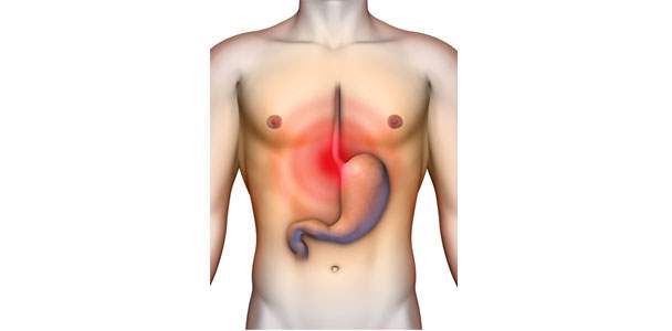 Gastrit Belirtileri Nelerdir?