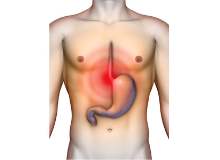 Gastrit Belirtileri Nelerdir? Gastrit Belirtileri Nelerdir?