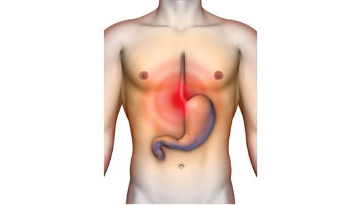 Gastrit Belirtileri Nelerdir?