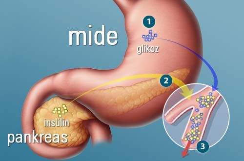 Gastritin Nedenleri Nelerdir?