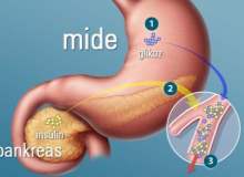 Gastritin Nedenleri Nelerdir? Gastritin Nedenleri Nelerdir?
