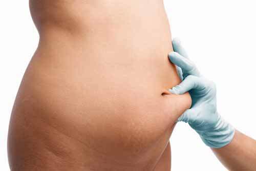 Liposuction, Kadınlar için Vaser Hi Def