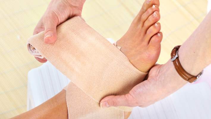 Ayak Bileği Kırığının Tedavisi