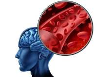 Felç ve Felç Riskini Arttıran Etmenler Felç ve Felç Riskini Arttıran Etmenler