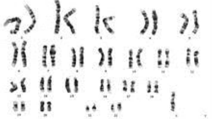 Süper Dişi Sendromu