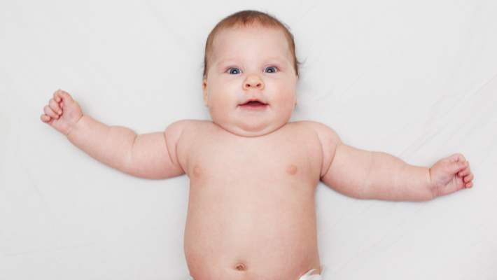 Bebeklerde Göbek Fıtığı