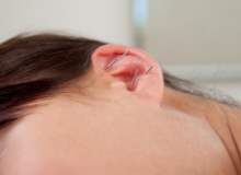 Kilo Kaybı İçin Kulaktaki Akupunktur Noktaları