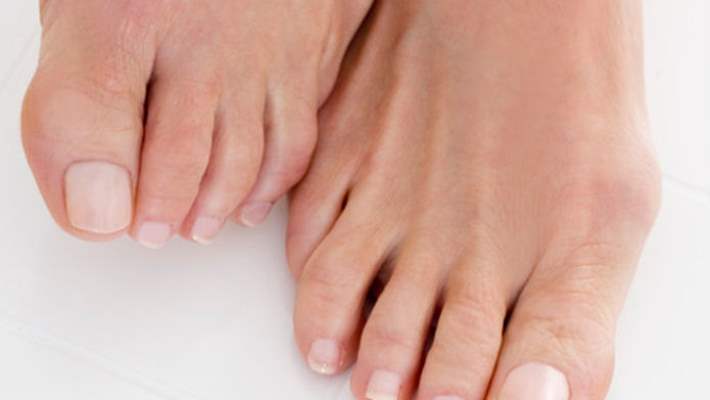 Ayak Tırnaklarında Sararma Neden Olur