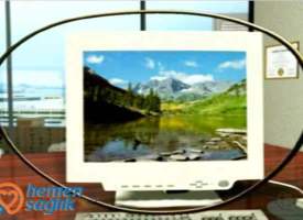 Bilgisayar Görme Sendromu (CVS) Bilgisayar Görme Sendromu (CVS)