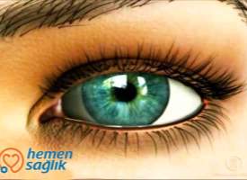 Göz Kapağı İltihabı (Blefarit) Nedir? Göz Kapağı İltihabı (Blefarit) Nedir?