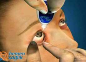 Göz Damlası Uygulaması Göz Damlası Uygulaması