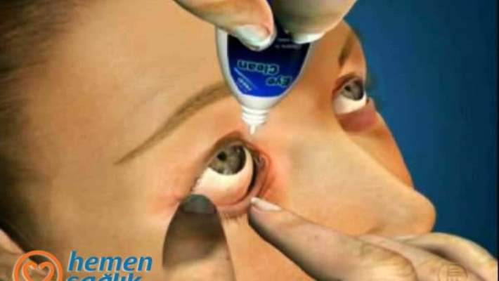 goz damlasi uygulamasi hemen saglik