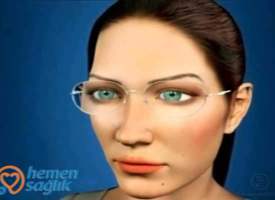 Katarakt Tedavisi Bilgilendirme video Katarakt Tedavisi Bilgilendirme video