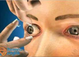 Kontakt Lensle ilgili bilgilendirici video Kontakt Lensle ilgili bilgilendirici video