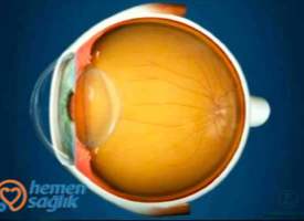 Retina Nedir Retina Nedir
