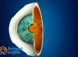 Vitreus Nedir Vitreus Nedir