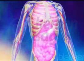 Akut Myeloid Lösemi (AML) Akut Myeloid Lösemi (AML)