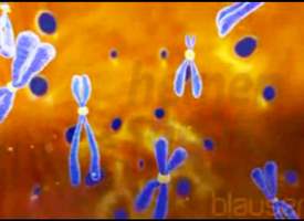 Kronik Myeloid Lösemi (KML) Hastalığı Kronik Myeloid Lösemi (KML) Hastalığı