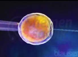 Tüp Bebek (IVF)