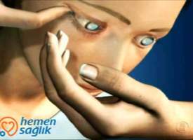 Kontakt Lensin Çıkarılması Kontakt Lensin Çıkarılması
